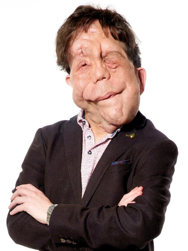 Adam Pearson